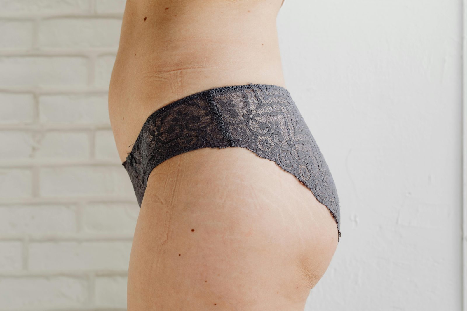 Silhouettes mettant en valeur le galbe des fesses avant traitement d'augmentation du volume fessier à la clinique Le Centre au Québec | Silhouettes highlighting buttock contour before non-surgical buttock volume enhancement treatment at Le Centre clinic in Quebec