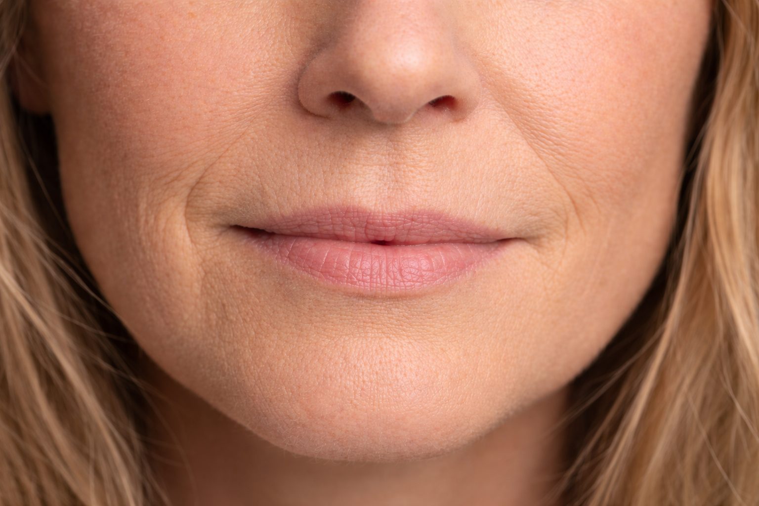 Injection d'agents de comblement pour les lèvres et les sillons du bas du visage à la clinique Le Centre au Québec | Dermal filler injection for lips and lower-face lines at Le Centre clinic in Quebec